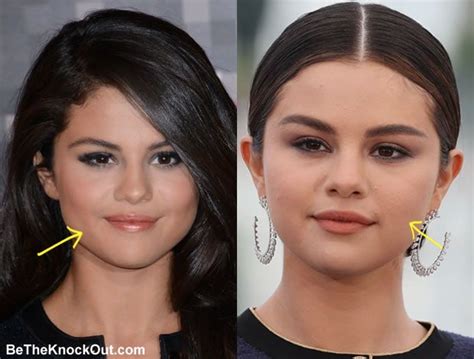 selena gomez nose|Selena Gomez Reacts to Plastic Surgery。